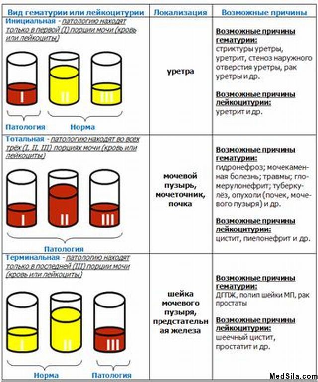 Трехстаканная проба